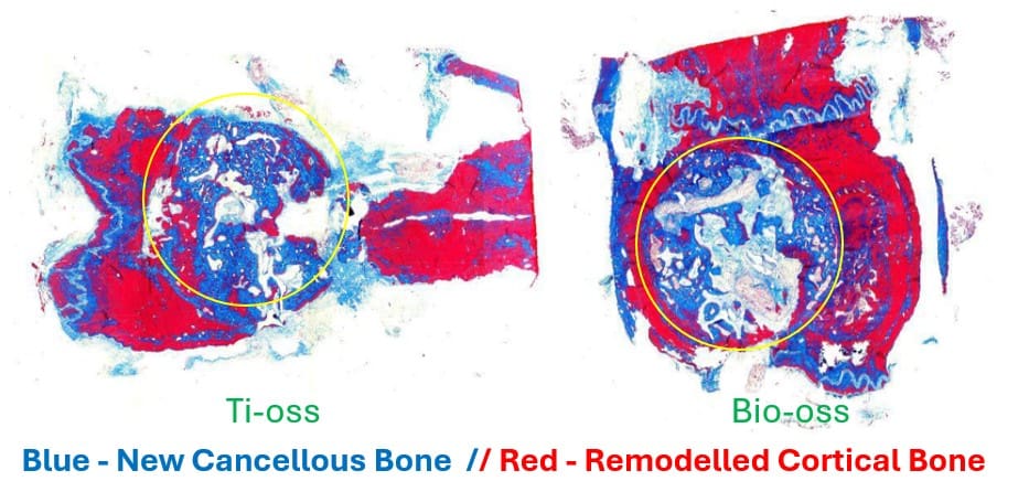 more bone than bio-oss