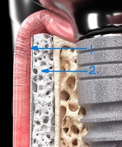 Powerbone Flex tissue support matrix