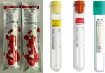 PRP and Blood Tubes